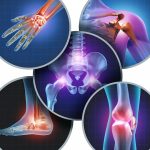 Joint Pain & Inflammation