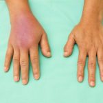 Reduced Inflammation & Swelling